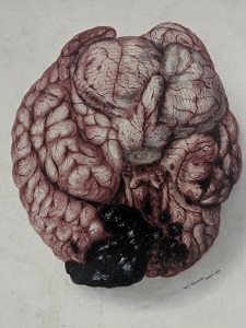 An image of a brain